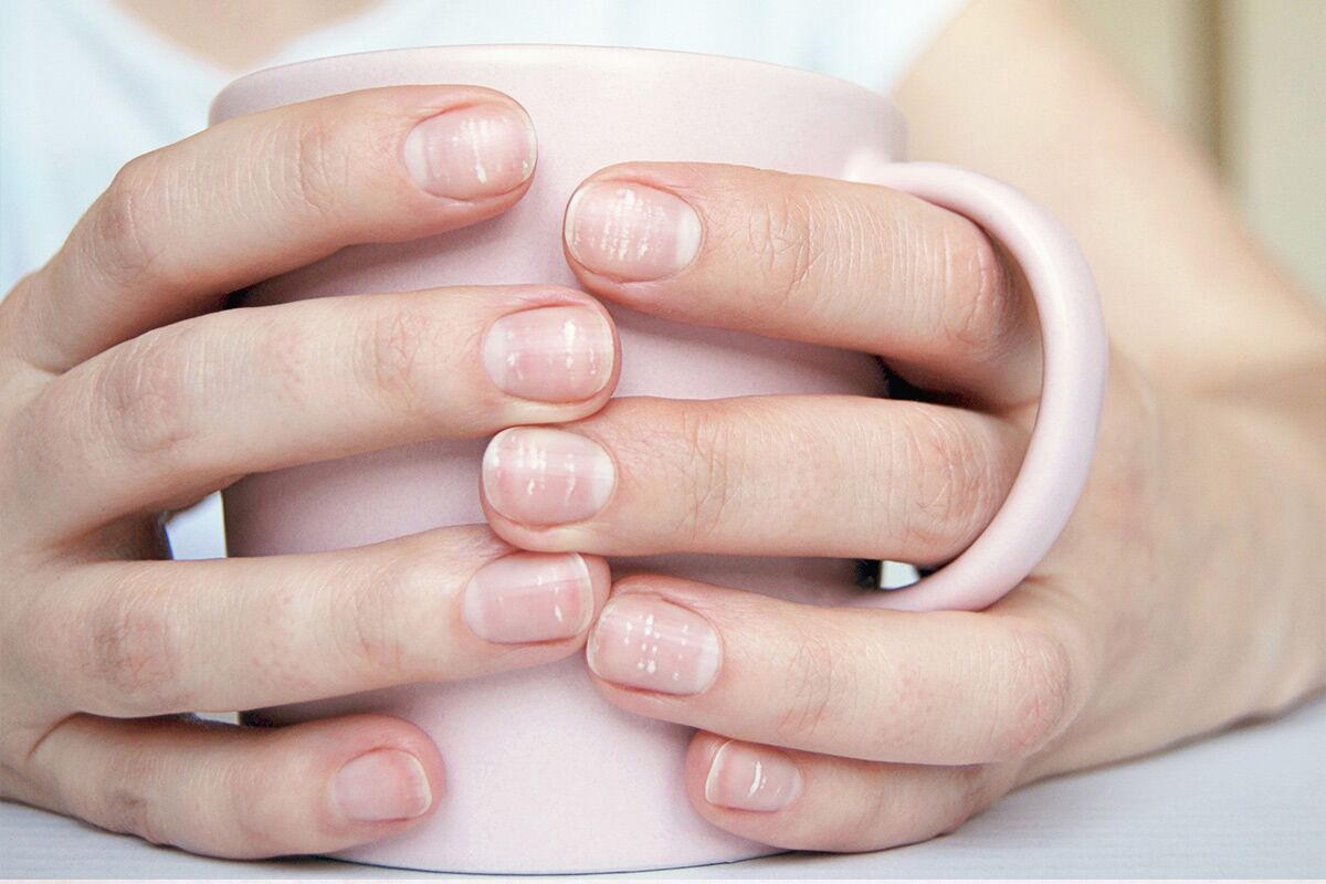 Yellow nails: Know the common causes for it! | Health News | Zee News